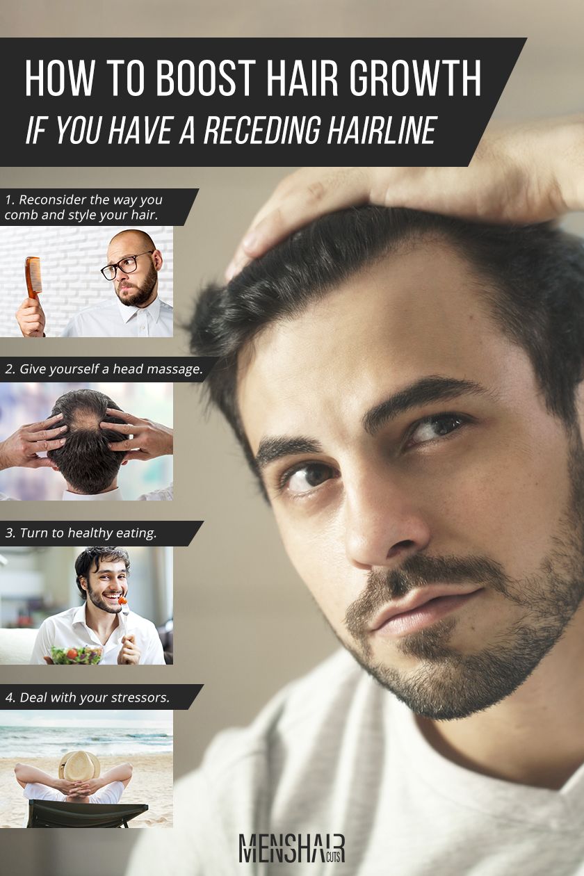 Here’s What You Must Do To Stop A Receding Hairline